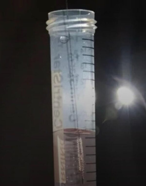 Leia mais sobre o artigo Teste do cotonete mostra boa eficácia para detectar Alzheimer precoce; VEJA